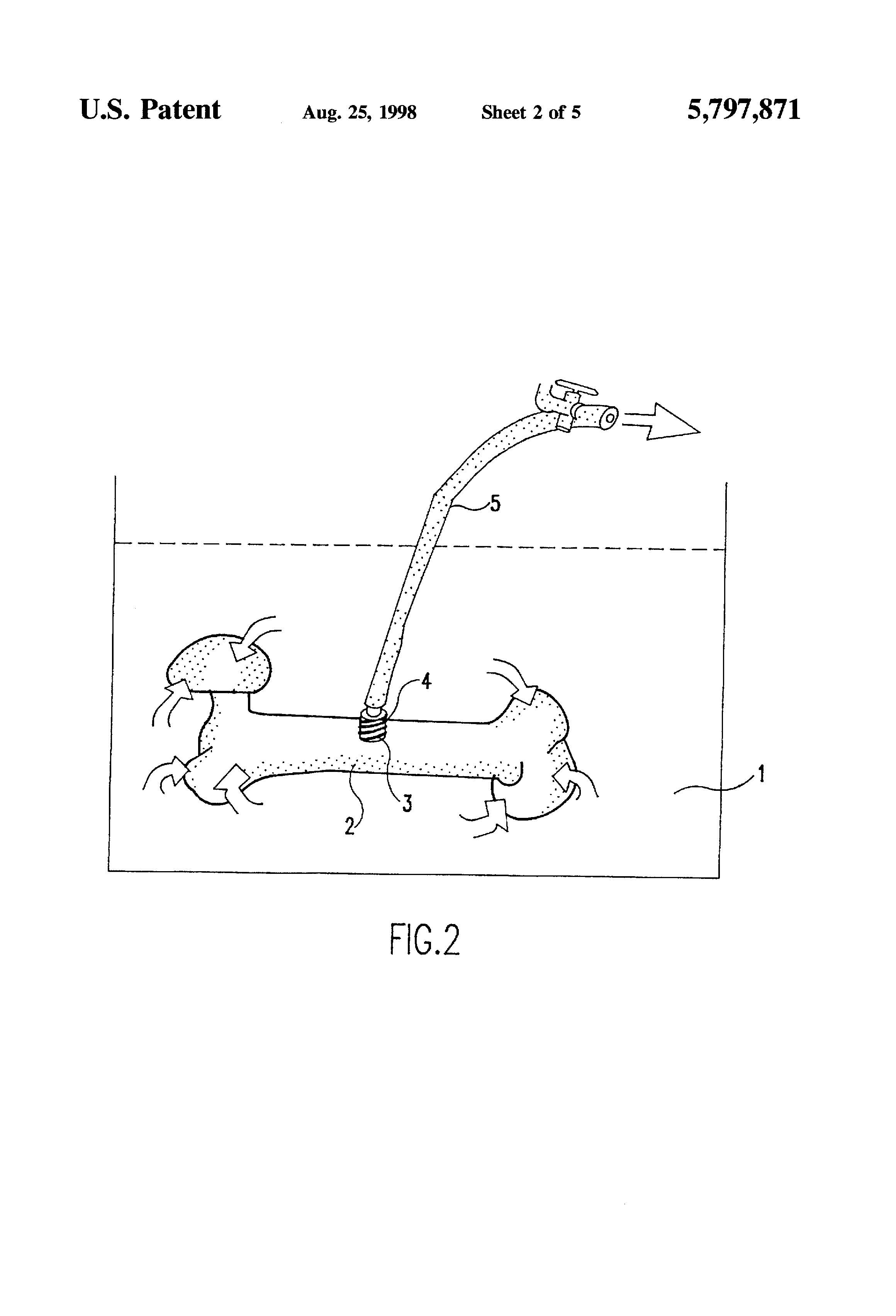 Patent-Illustration-Ultrasonic-Cleaning-Of-Allograft-Bone-_Page_3