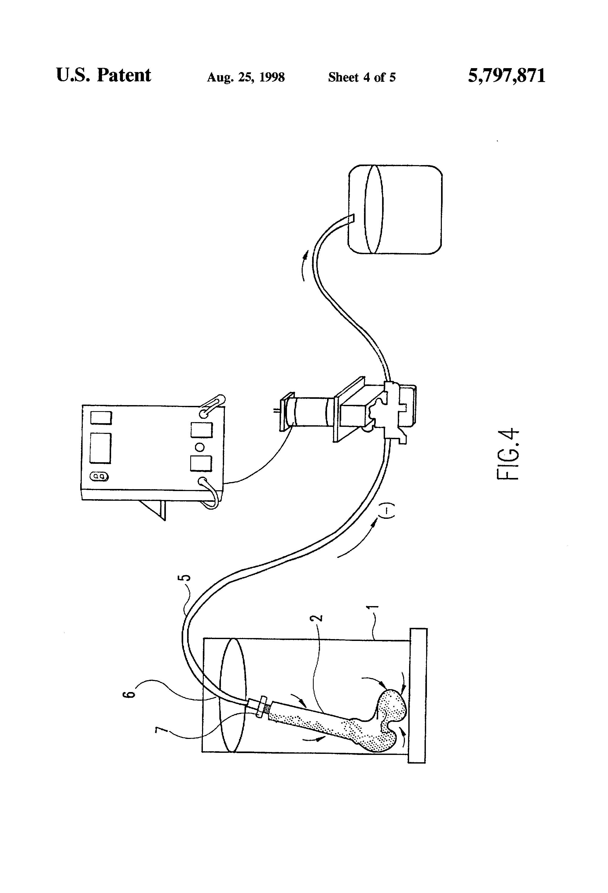 Patent-Illustration-Ultrasonic-Cleaning-Of-Allograft-Bone-_Page_5